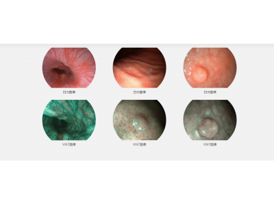 开立医疗全高清电子内镜系统图5