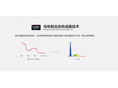 开立医疗全高清电子内镜系统图6