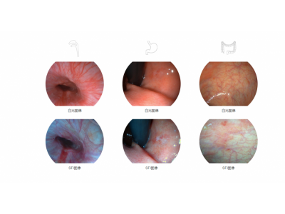 开立医疗全高清电子内镜系统图7