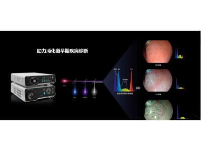 开立医疗全高清电子内镜系统图9