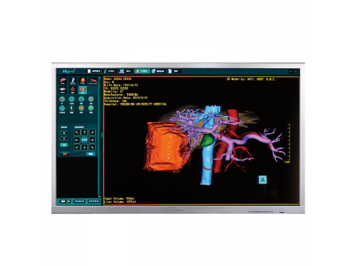 HME8C58 58吋8M手术室显示器图2