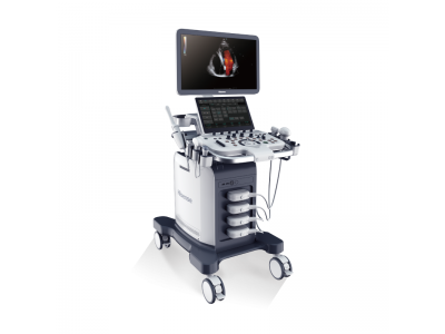 彩色多普勒超声诊断仪图2