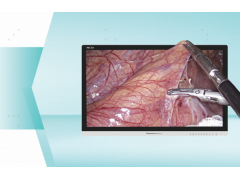 内窥镜|海信4K 3D内窥显示器革新医疗显示体验